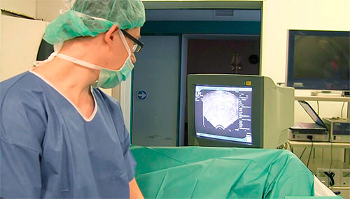 Биопсия простаты