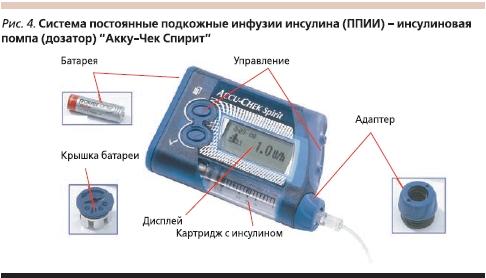Инсулиновая помпа