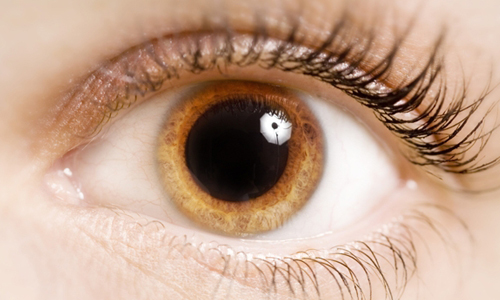 Расширенный зрачок