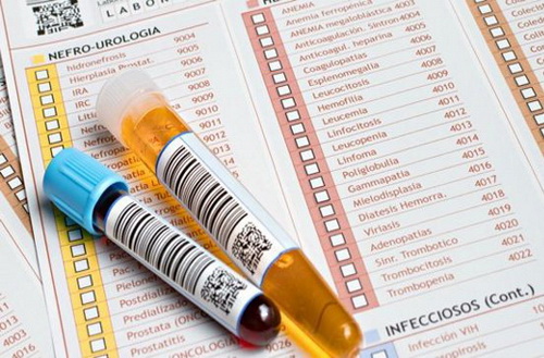 Результат анализа