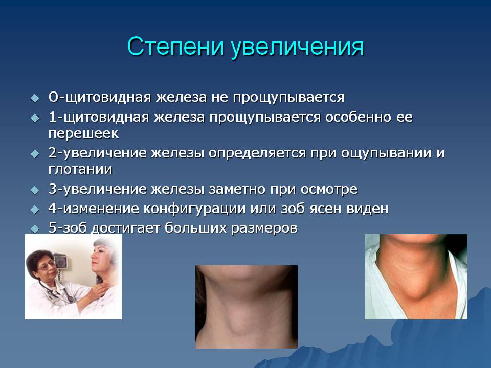 Степени увеличения щитовидной железы