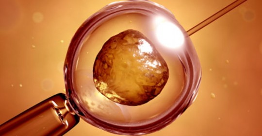 яйцекоеика