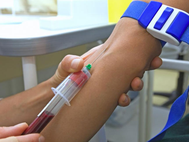 Забор крови