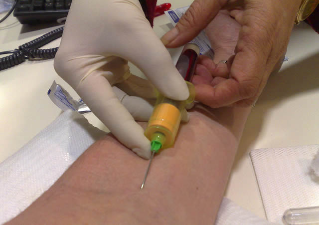 Забор крови